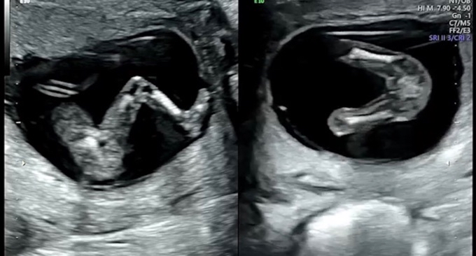 Community Article Image