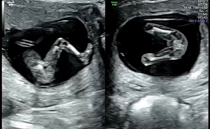 Community Article Image