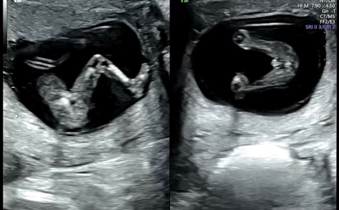 Community Article Image