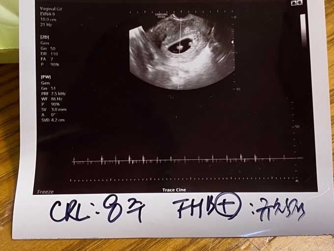 Community Article Image