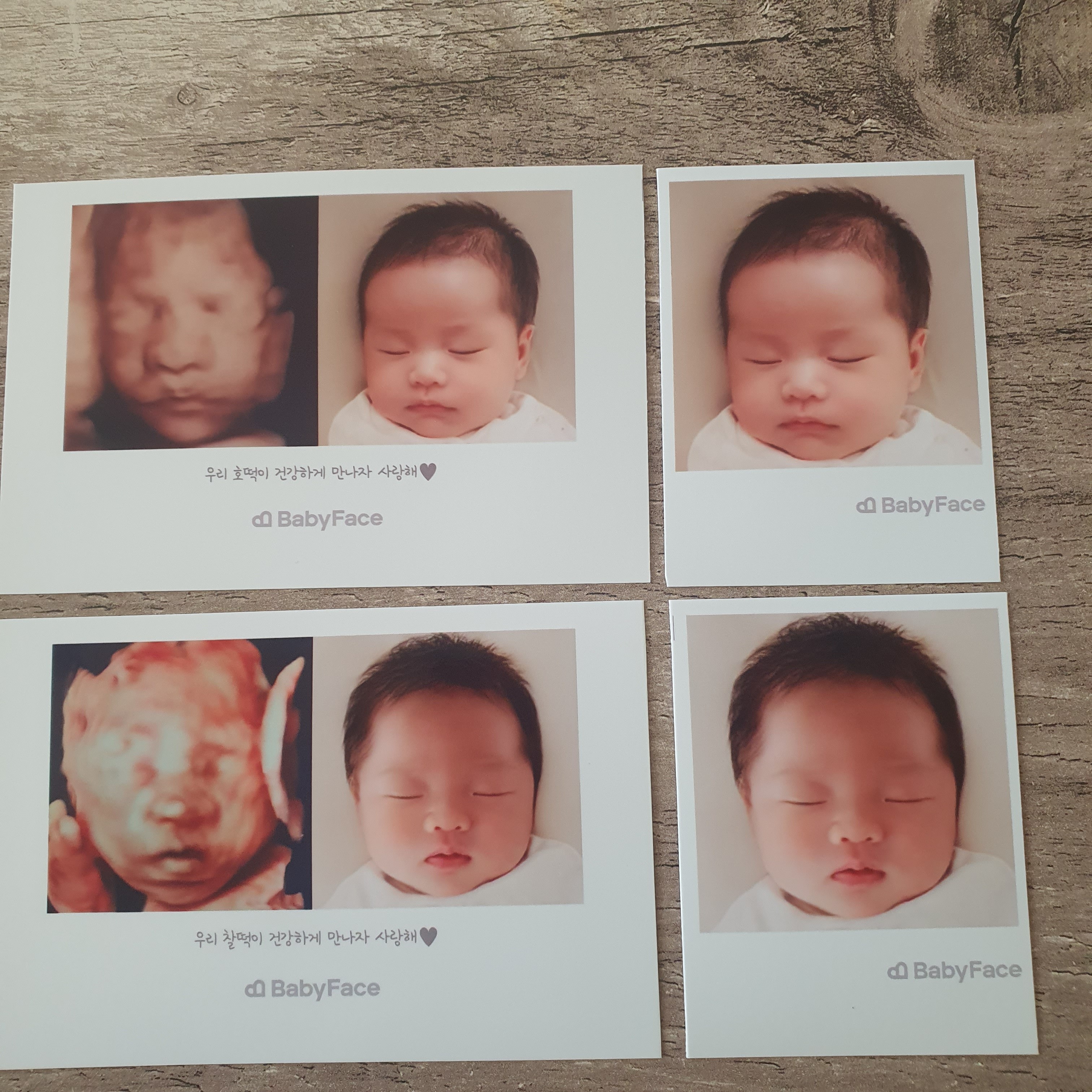 조산방지 질정 넣은 뒤 밑에 통증 ㅠㅠ | 임신질문 | 마미톡 커뮤니티